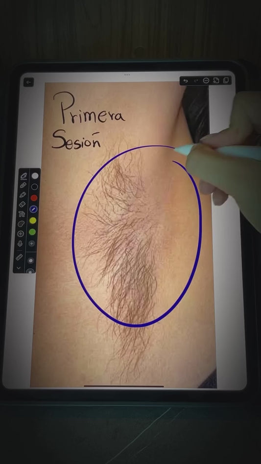 Depilacion Laser - Paquetes